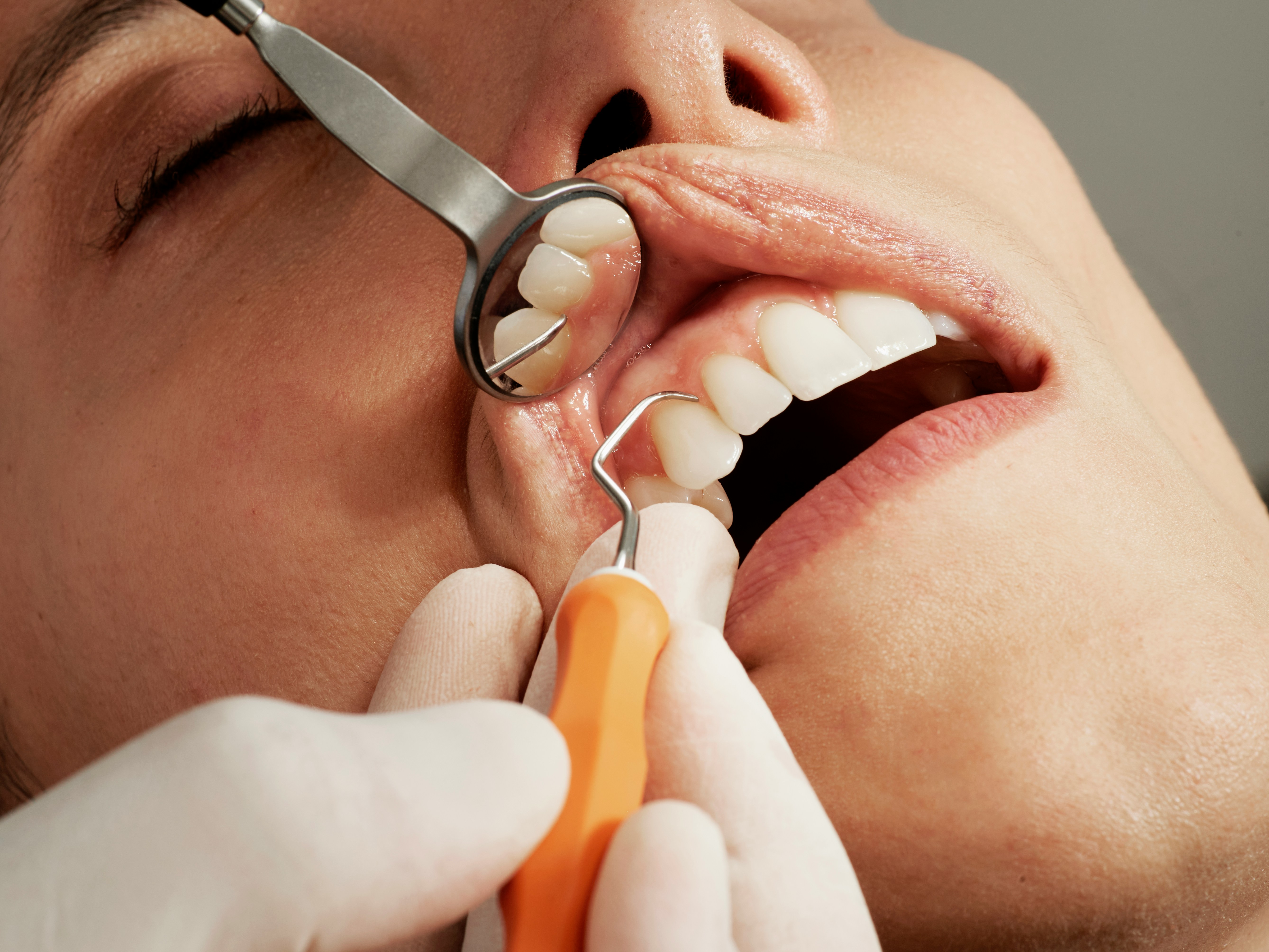 Patient receiving dental treatment abroad