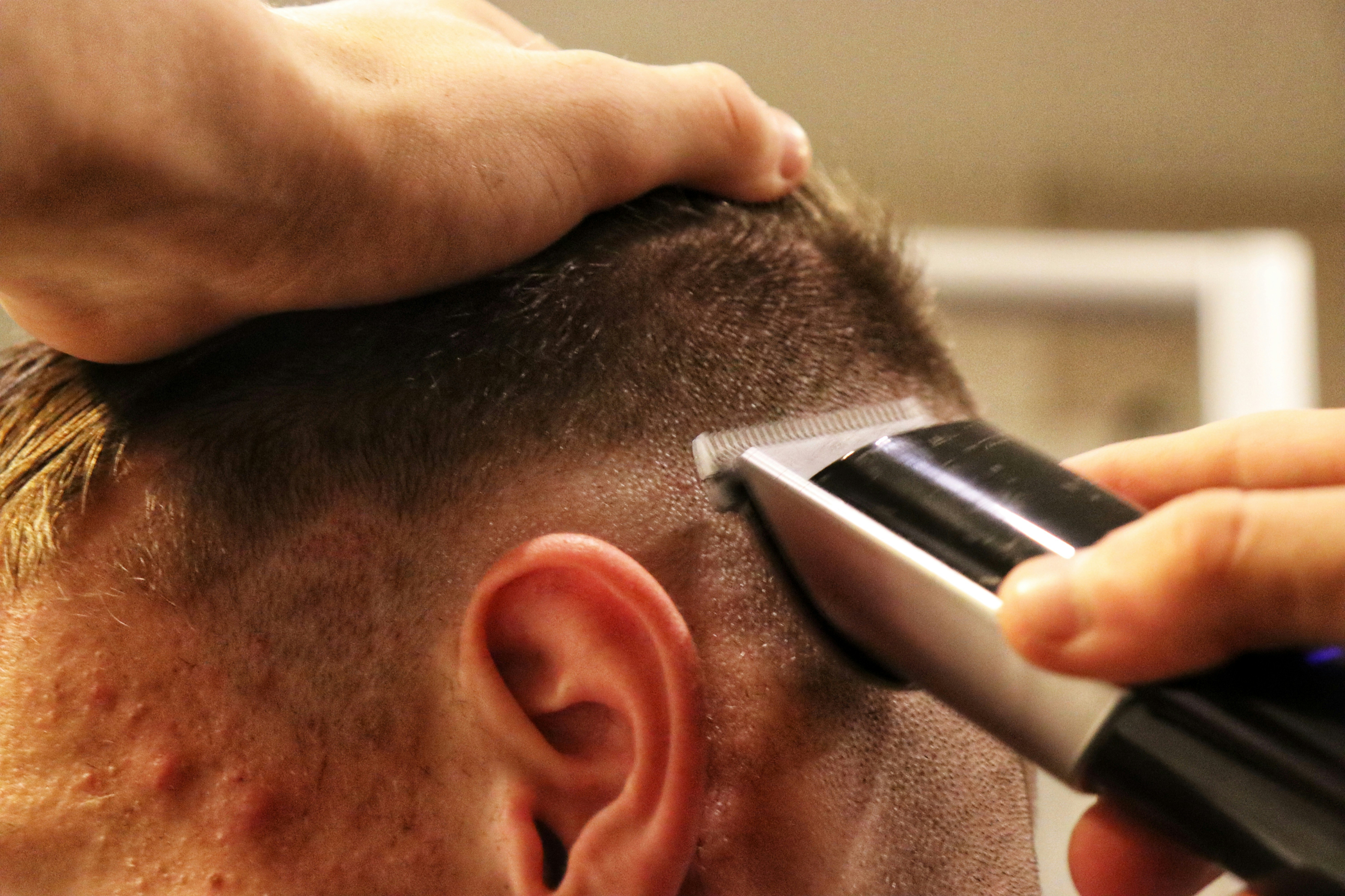 Hair transplant abroad insurance